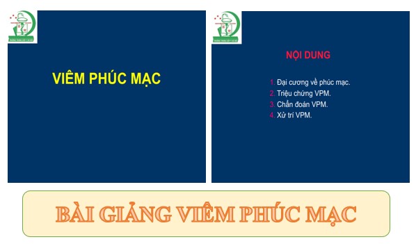 Bài giảng viêm phúc mạc PPT, PDF