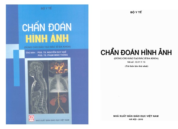 Ebook Chẩn đoán hình ảnh Bộ Y tế PDF