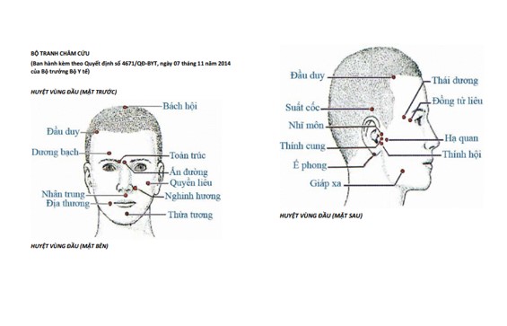 80 Huyệt thường dùng PDF